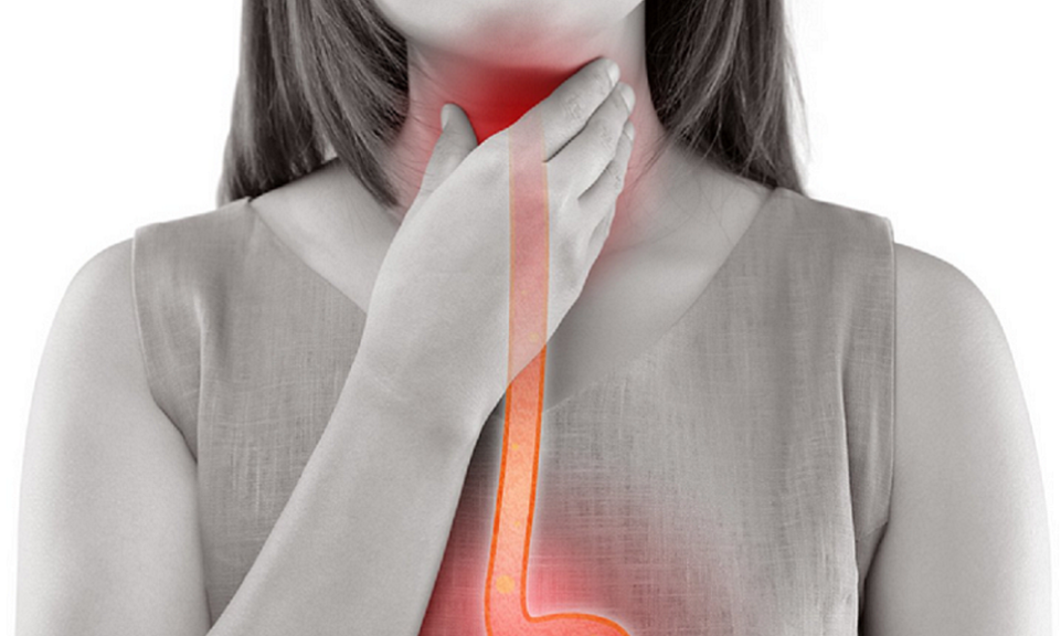 역류성 식도염 증상, 자연치료 방법, 좋은 음식 섬네일