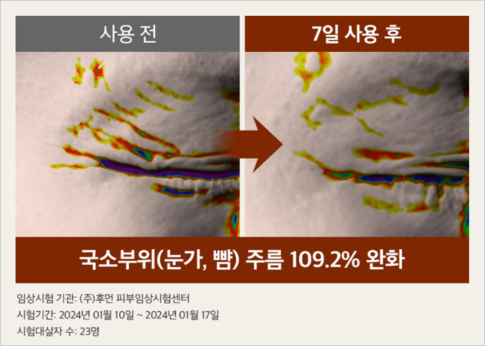 마미케어 율무크림 후기, 효과, 사용법, 부작용