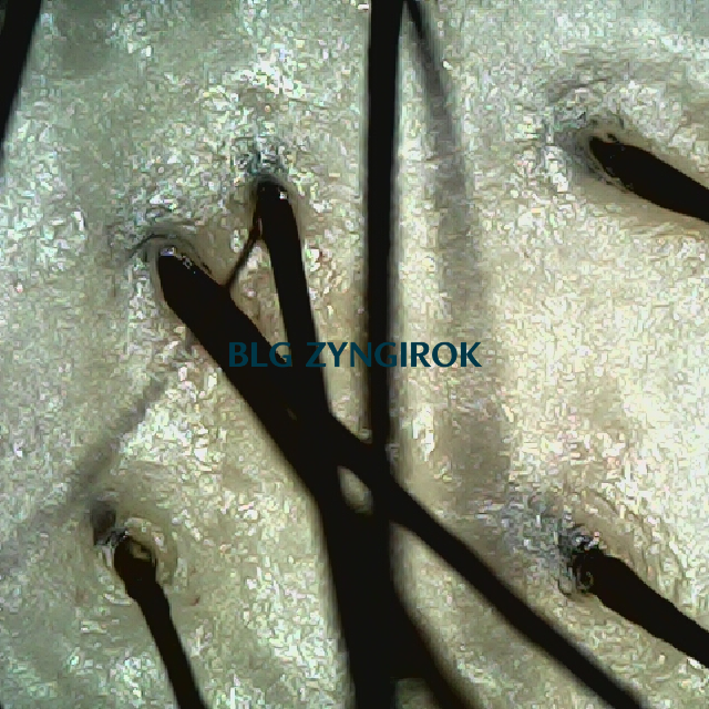 탈모 극복 프로젝트 - 정수리 두피 모습이다.