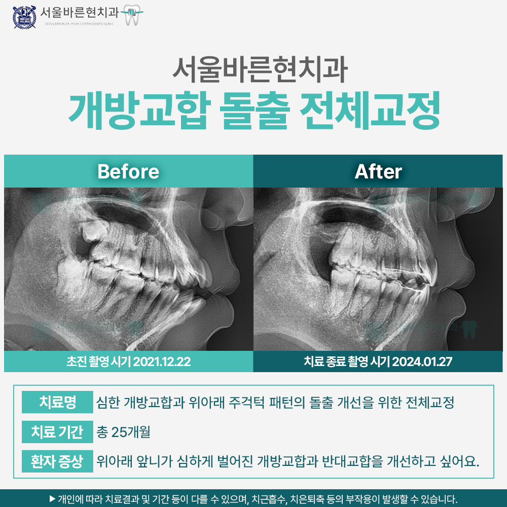 부산교정치과