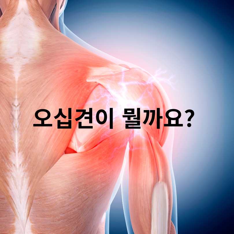 오십견 증상과 집에서 할 수 있는 운동법