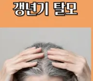 머리카락이 빠지고 정수리가 보이면 여성 탈모 진행별 증상과 해결책