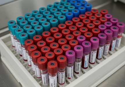 난소암 병기 및 치료법