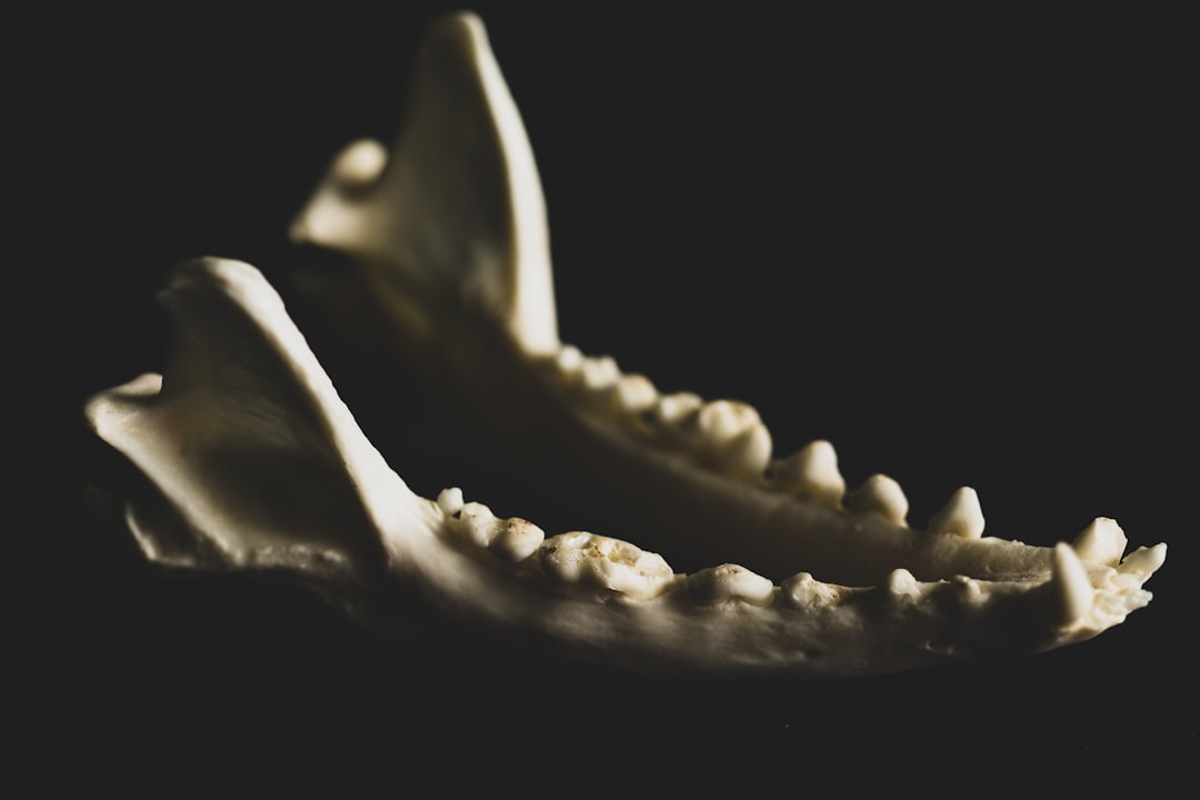 Jaw