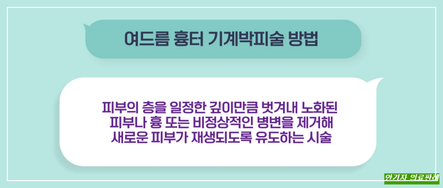 기계 박피 방법