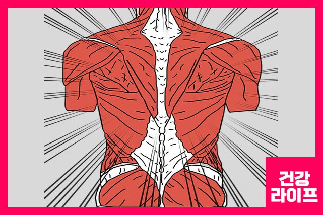 증상 - 하반신 당김, 마비, 걷기가 불편함