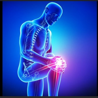 류마티스 관절염 사진입니다.