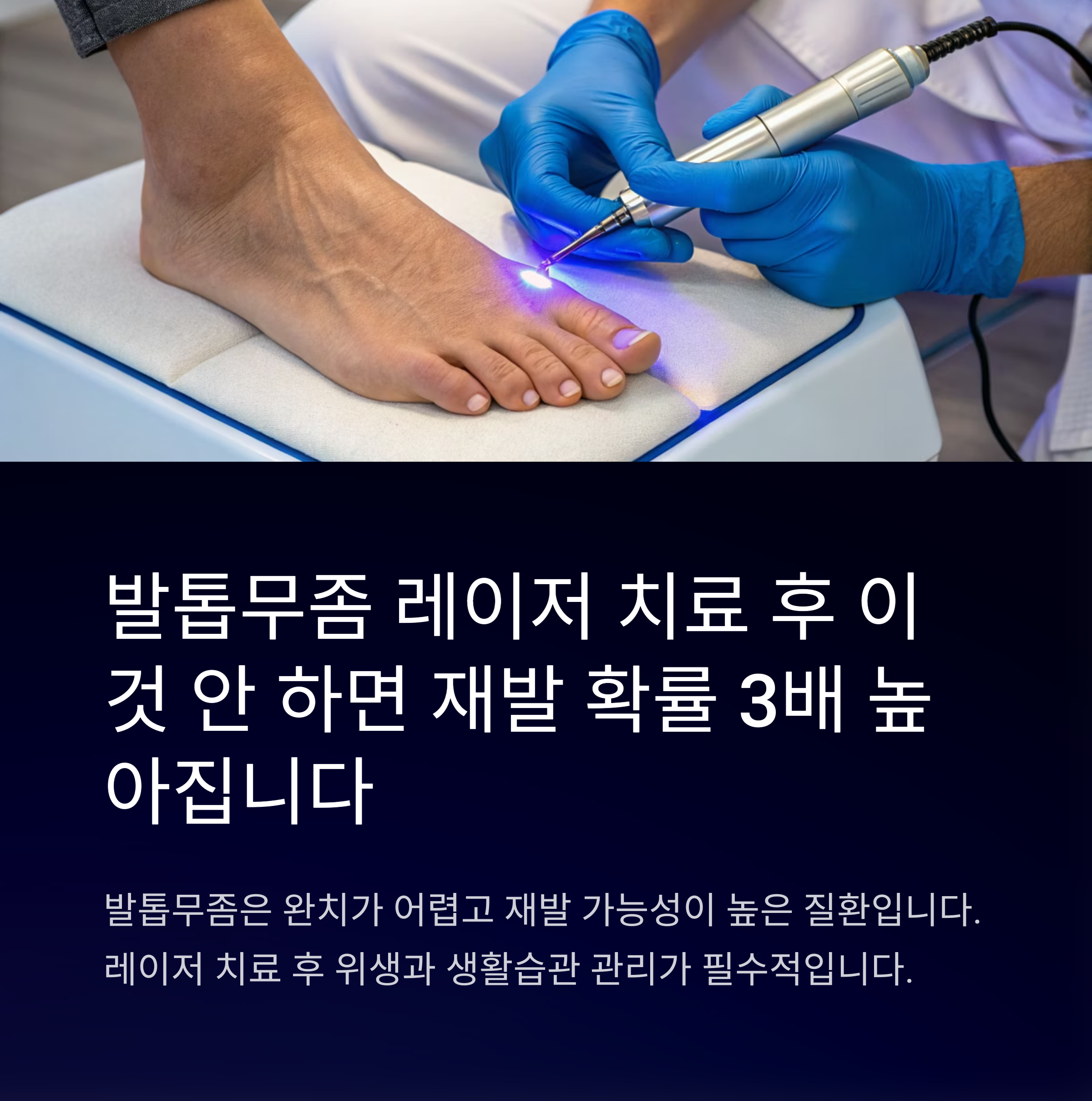 발톱무좀