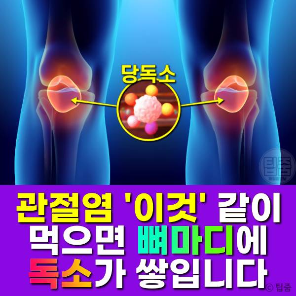 관절염에 나쁜 음식,관절염에 안 좋은 음식,팁줌
