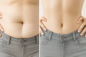 마운자로 처방 받을 수 있는 병원 찾는 법