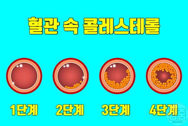참외 효능 콜레스테롤 참외씨 참외껍질 참외꼭지 효능 참외부작용 하루섭취량