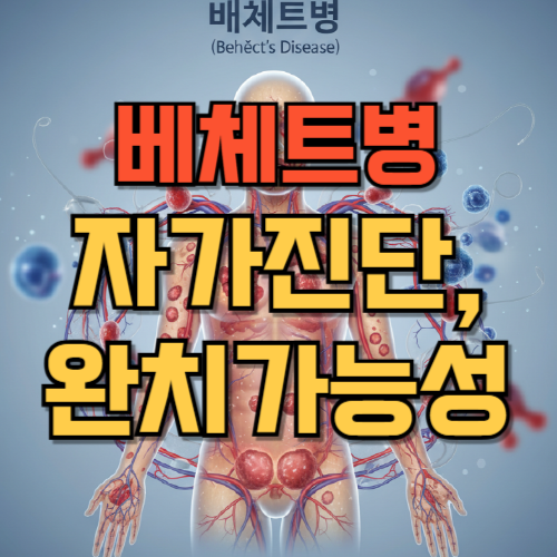 베체트병 자가진단_완치가능성