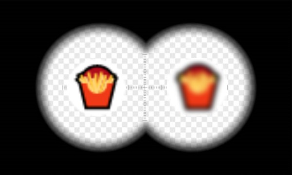 옆으로 누워서 스마트폰, 짝눈 시력 눈매 교정, 사시 부동시 원인