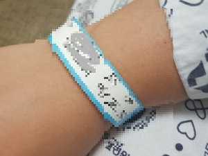 전남대병원 갑상선암 수술 후기(조진성 교수)