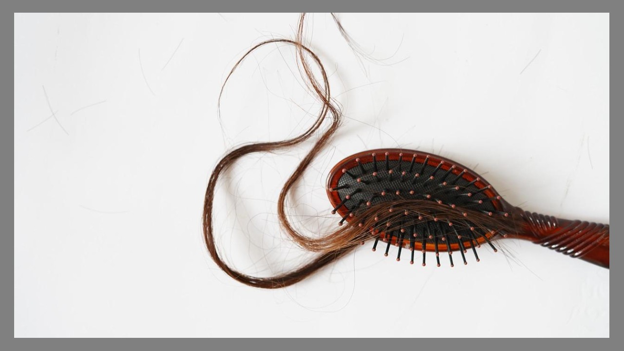 탈모 관련 사진