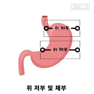 위저선 용종