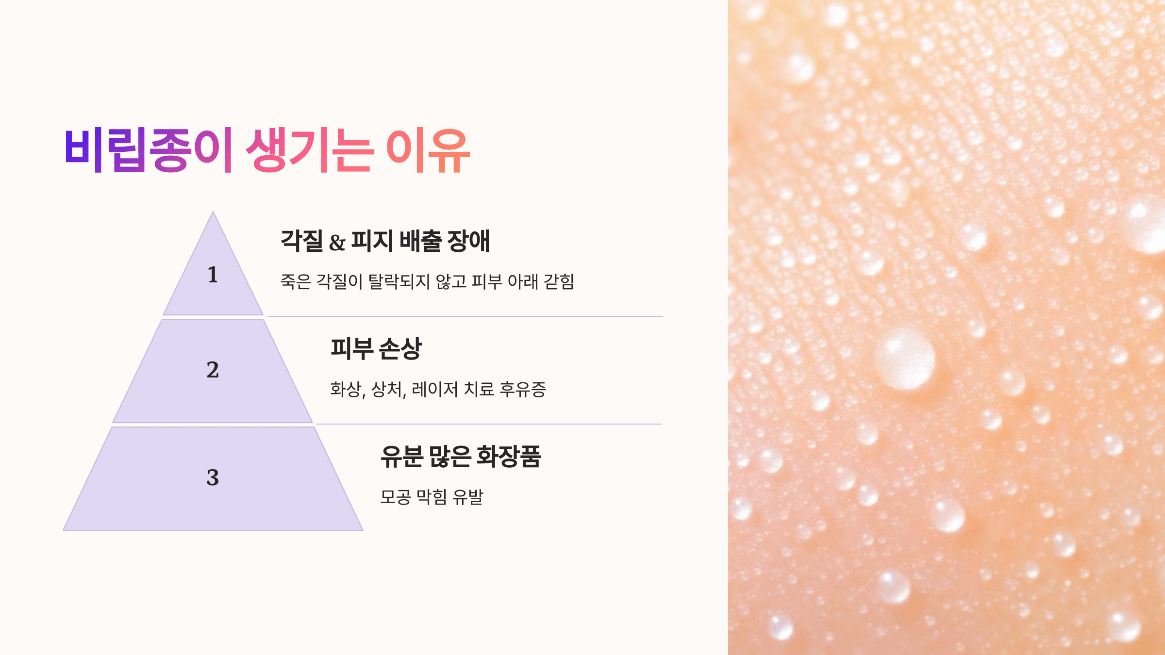 비립종과 관련된 사진입니다.