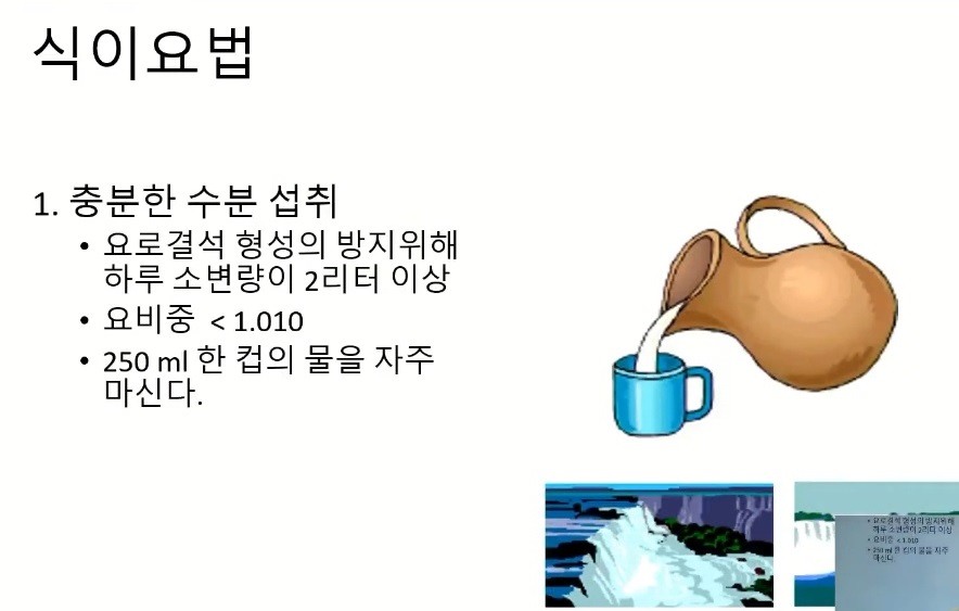 EBS명의-요로결석-구교철교수-식이요법