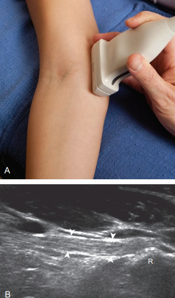 안쪽검사(medial)