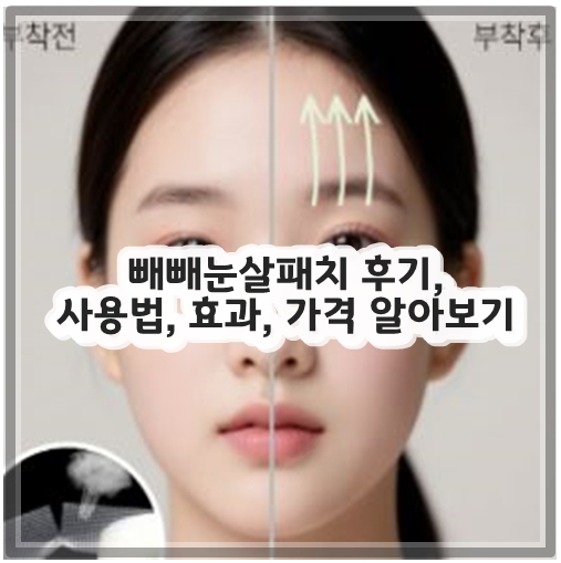 빼빼눈살패치 후기, 사용법, 효과, 가격 알아보기