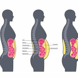 40대 남성 복부비만이 위험한 이유