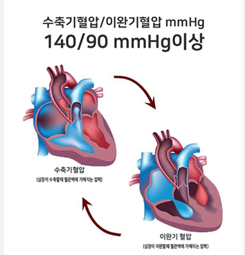 50대 정상혈압범위와 회복방법