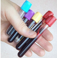 감마지티피-사진9