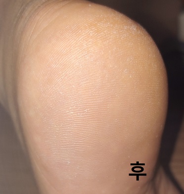 셀로몬-사용후