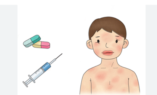 아토피와 알레르기 차이점