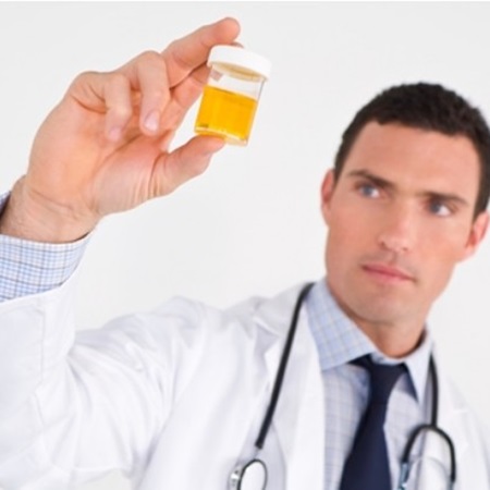 소변색깔이-적갈색-이라면