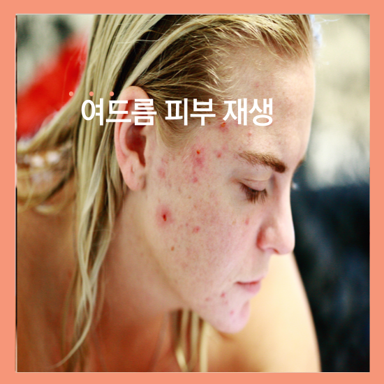 비판텐 연고