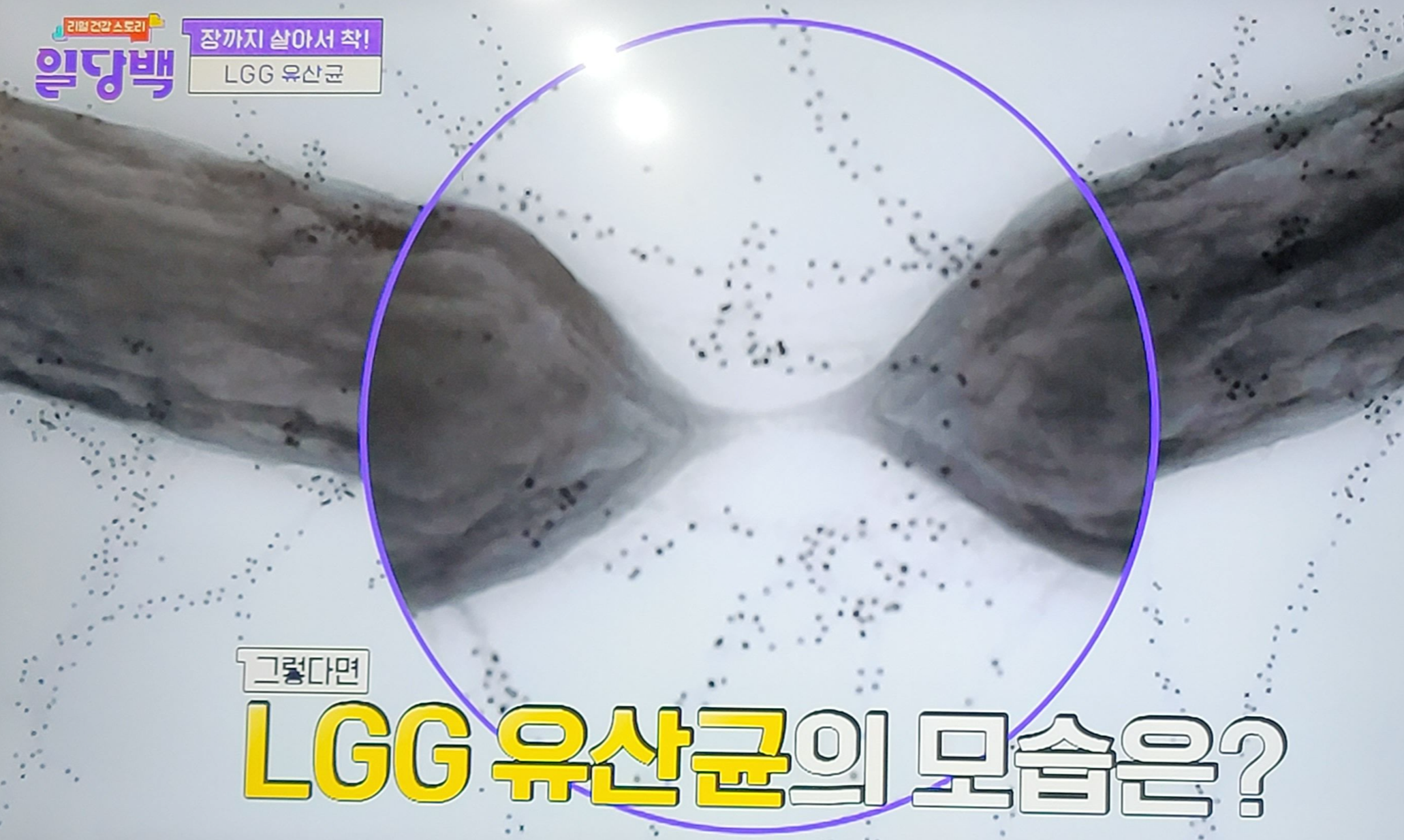 LGG유산균의 섬모