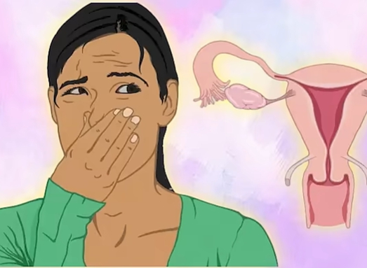 생리 냄새가 지독해요