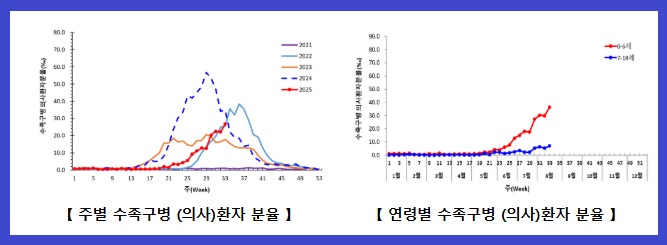 수족구병