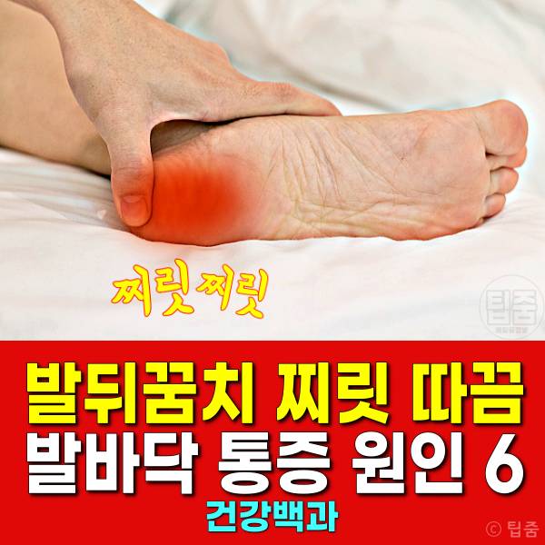 발뒤꿈치 찌릿 따끔 발바닥 전기 통증