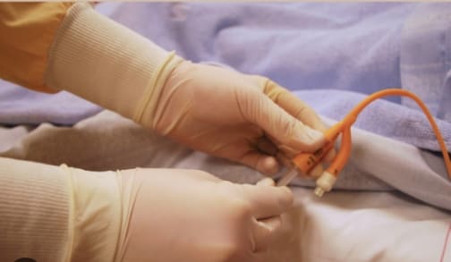 혈관 진입 미니 로봇, 수술 완료!(한양대팀) VIDEO: Small Magnetic Robot Completes Vascular Surgery