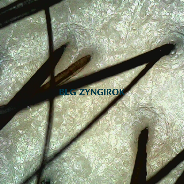 탈모 극복 프로젝트 - 정수리 두피 모습이다.