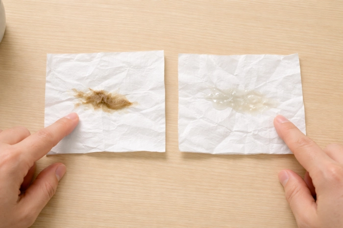 대변에 흰 점액질이 묻어 나올때