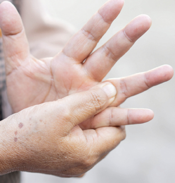 류마티스 관절염 초기증상 12가지 총정리 섬네일