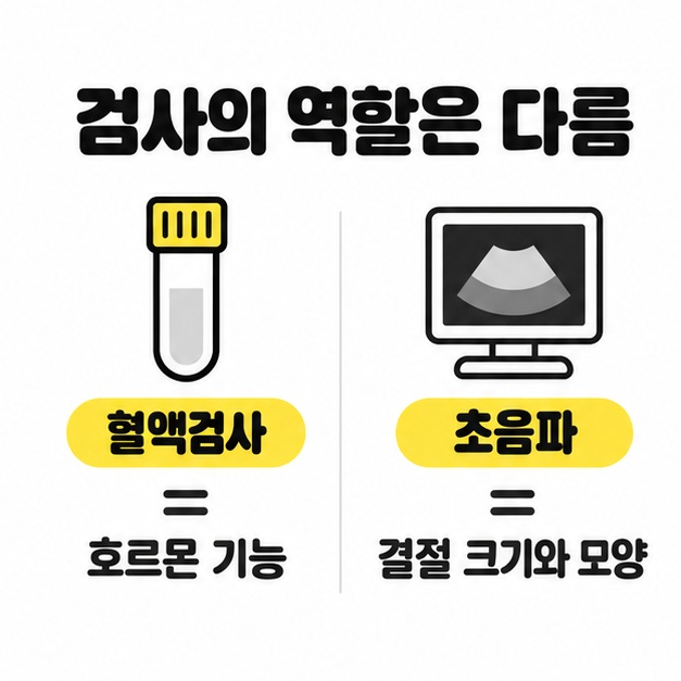 혈액검사는 호르몬 기능 초음파는 결절의 크기와 모양을 확인하는 검사 역할 비교 도식