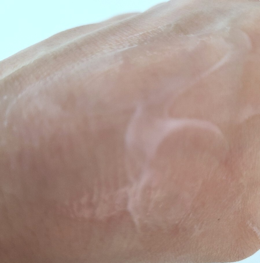 일리윤 튼살크림 제형