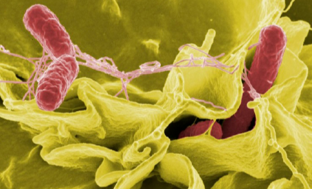 살모넬라균을 현미경으로 자세히 본 균체의 모양