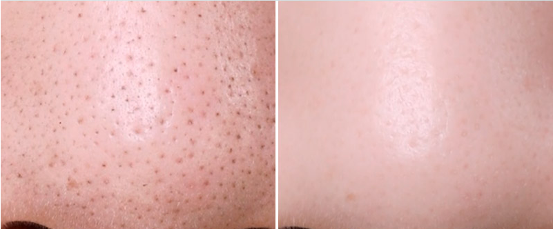 네이처원 리얼 멜팅 클리너 효과 후기