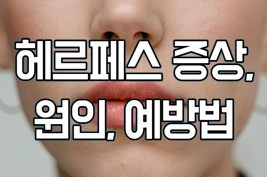 헤르페스-증상-원인-예방법