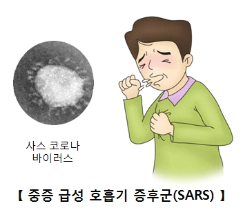 사스 관련주
