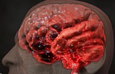 대상포진 초기 증상