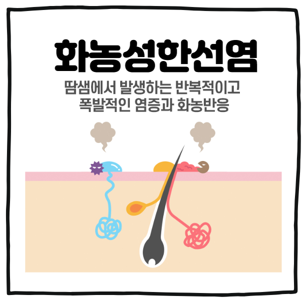 화농성 한선염2