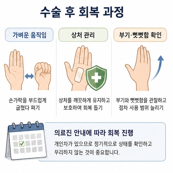방아쇠 수지 수술 뒤 손가락 움직임과 상처 관리, 부기와 뻣뻣함을 확인하는 회복 과정을 보여주는 이미지