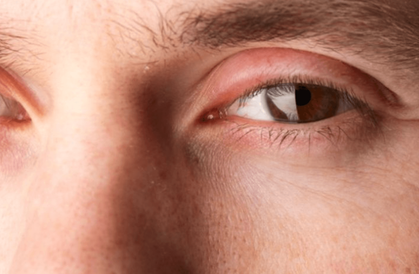 자고 일어나니 눈 부음