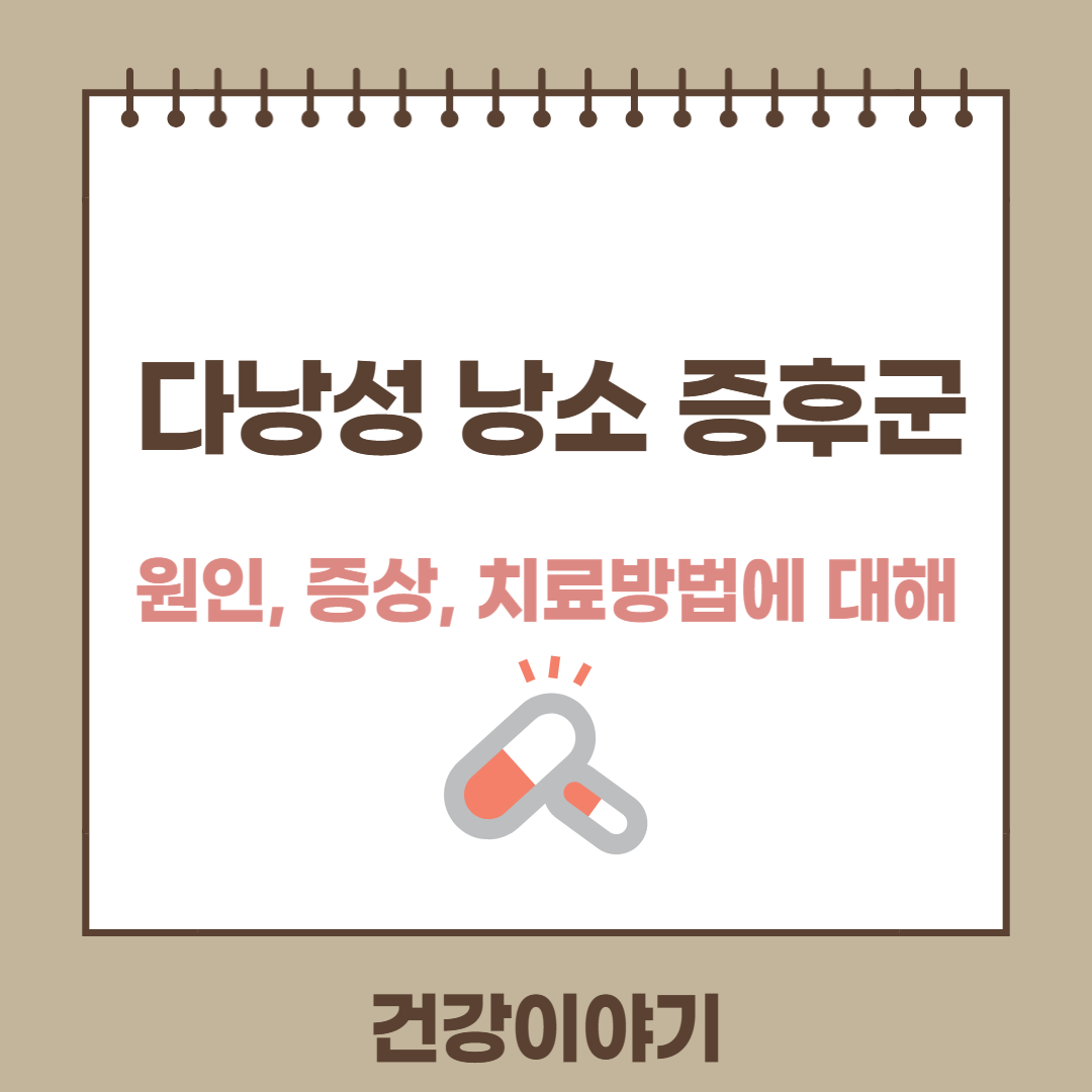 다낭성 낭소 증후군에 대해